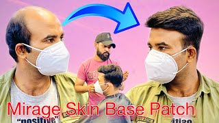 Mirage Skin Base Patch | Hair Patches For Men | Full Natural Look Patches | 9599858612
