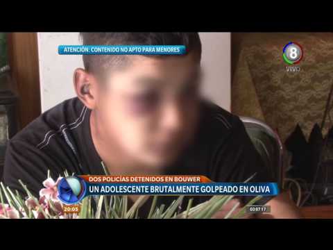 Un adolescente brutalmente golpeado en Oliva