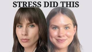 Cortisol Face: What It Is & How to Fix It