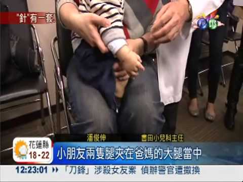 無尾熊固定法! 嬰兒打針不亂動