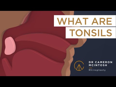 About tonsils and a tonsillectomy