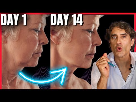 Jowls // TECHNIQUES THAT ACTUALLY WORK