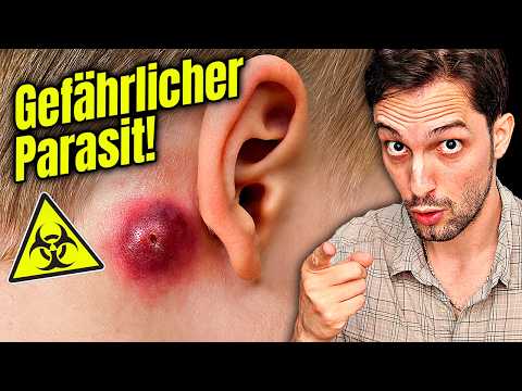 Tödlicher Parasit in Europa! Sogar als Biowaffe eingestuft!