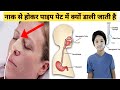 नाक में नाली क्यों और कैसे लगाई जाती ह�