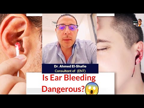 The Truth About Ear Bleeding and Blood Pressure REVEALED  | ProHealthConsults