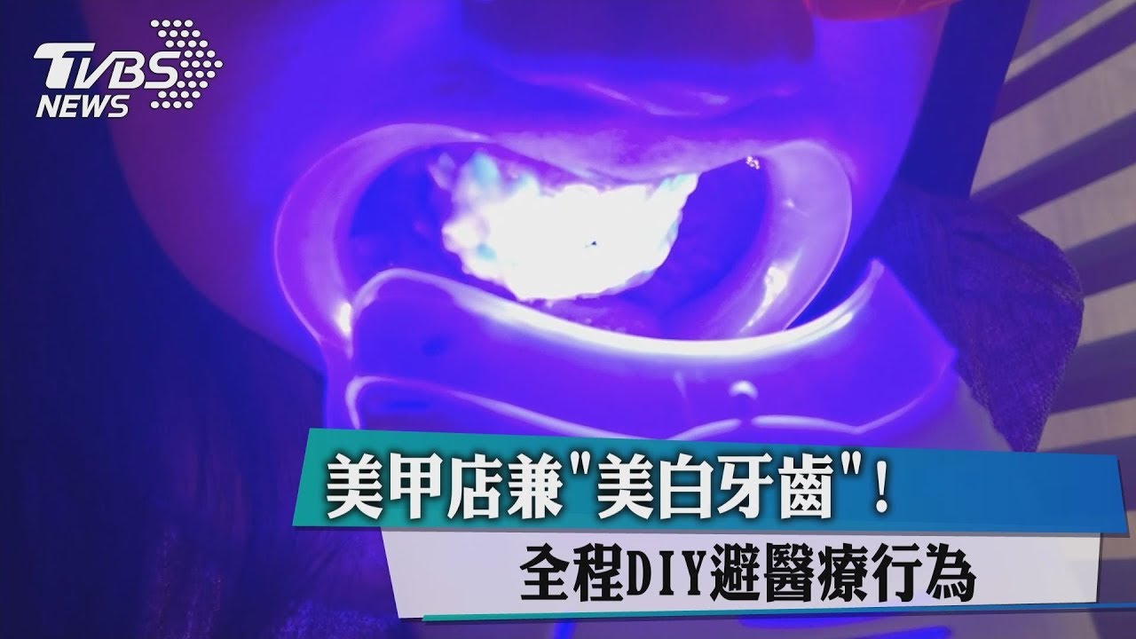 美甲店兼「美白牙齒」! 全程DIY避醫療行為