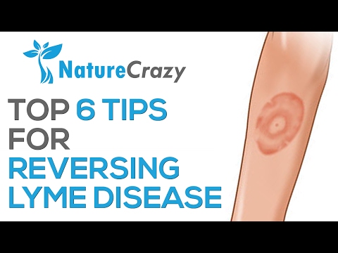 Nature Crazy's Top 6 Tips For Reversing Lyme Disease