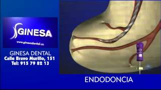 ENDODONCIA en GINESA Dental