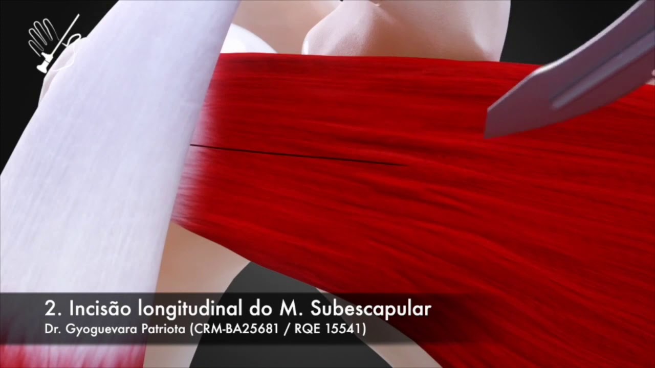 Gyoguevara Patriota-8