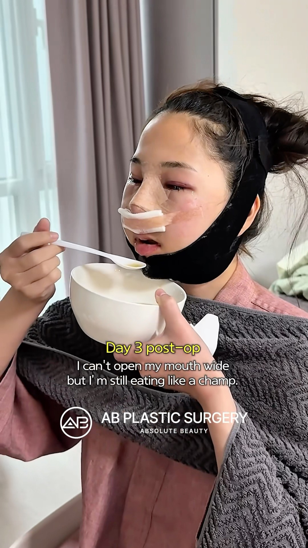 7 Days Post-Surgery in Korea, Still Seollen!