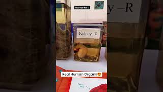 Download lagu Real Human Organs |MBBS First Year | Anatomy Museum #neet#2024#mbbs#motivation#cadaver mp3