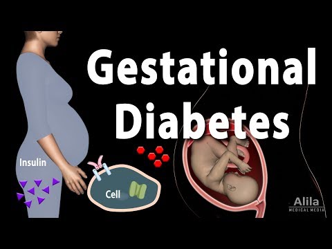 image-What is the main cause of gestational diabetes?