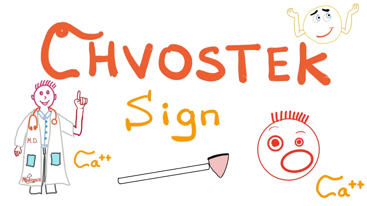 Chvostek Sign (Tetany: Hypocalcemia) | Clinical Signs