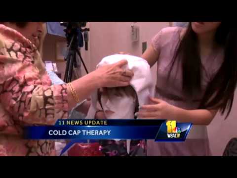Fund helps women get cold caps for cancer treatment