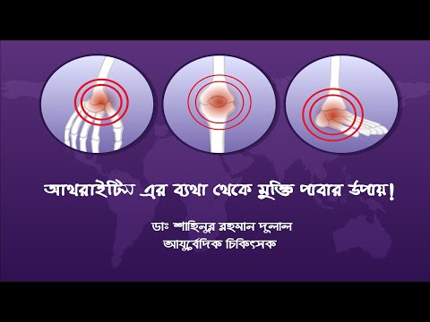 আথরাইটিস এর ব্যথা থেকে মুক্তি পাবার উপায়