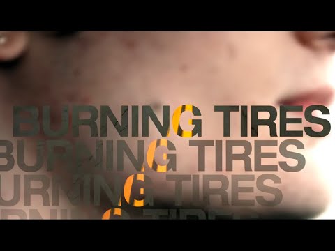 FROMTHEHEART - BURNING TIRES (feat. Knapsack) [Official Music Video]