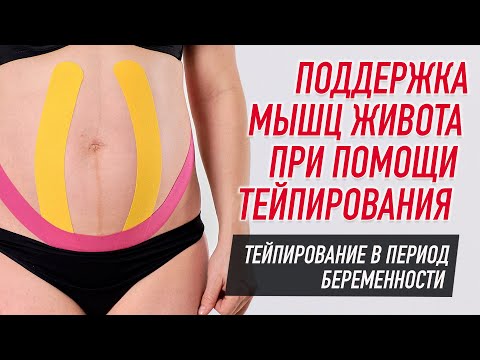 Кинезио тейп BBTape™ МАХ 5 см × 32 м красный Фото 11
