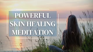 10 Minute Guided Meditation for Healing Skin | Heal Eczema, Acne, Rosacea, Psoriasis