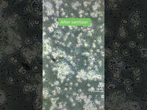 Bacteria VS hand sanitizer under the microscope!
