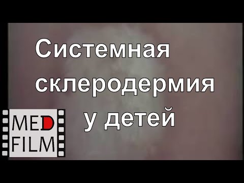 Посоветуйте хороший крем для суставов Схема связок и суставов