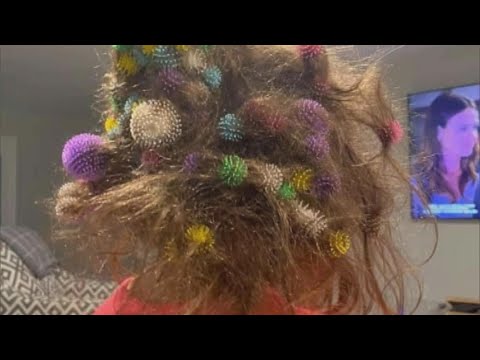 6-Year-Old Gets 150 Bunchems Velcro Balls Stuck in Her Hair