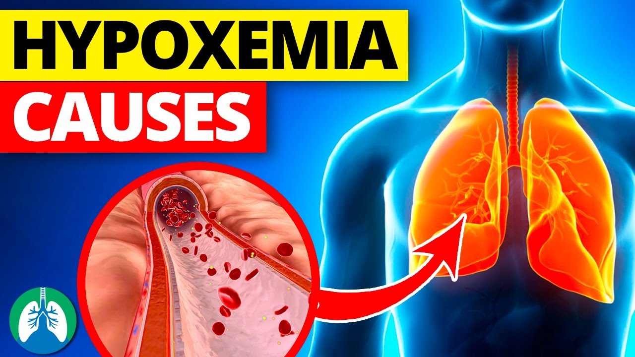 THIS is Causing Your Low Oxygen Levels | Hypoxemia Causes