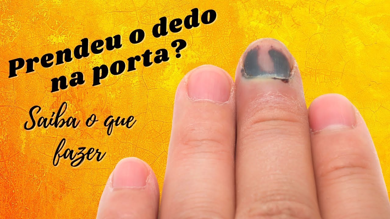 PRENDI O DEDO NA PORTA - O que devo fazer?