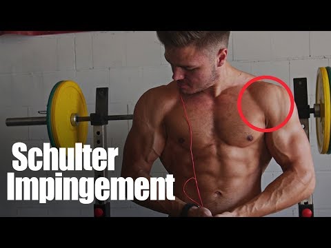 Was ist, wenn starke Schmerzen im Rücken zu tun Arthritis des Schultergelenkes Video Übungen
