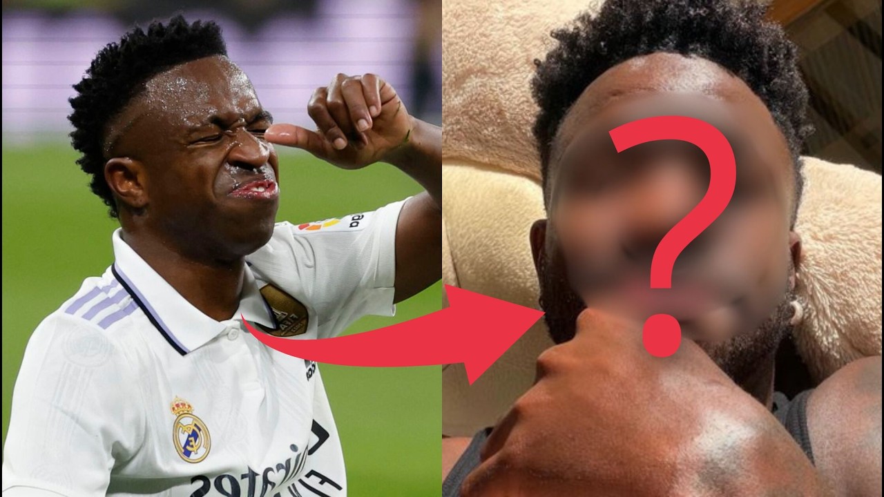 QUÉ RAYOS se HIZO VINICIUS JR en LA CARA
