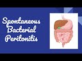 Spontaneous Bacterial Peritonitis SBP Causes Diagnosis Treatment And Prevention