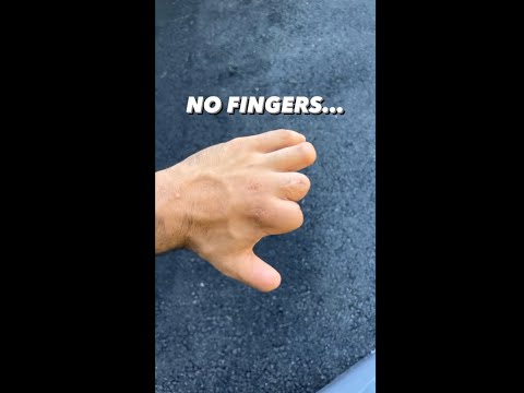 Zyzz - No Fingers No Feet..