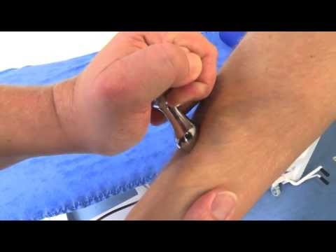 Faszienmanipulation nach Sven Kruse, Schulter Arm