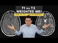 T1 vs T2 weighted MRI images: How to tell the difference