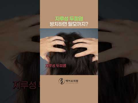지루성 두피염 방치하면❓ㅣ헤어로의원 전주점ㅣ