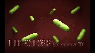 CDC Tuberculosis (TB) Transmission and Pathogenesis Video