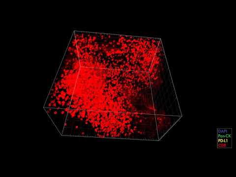 Segmentation and classification of tonsil tissue prepared by  the CLARITY method