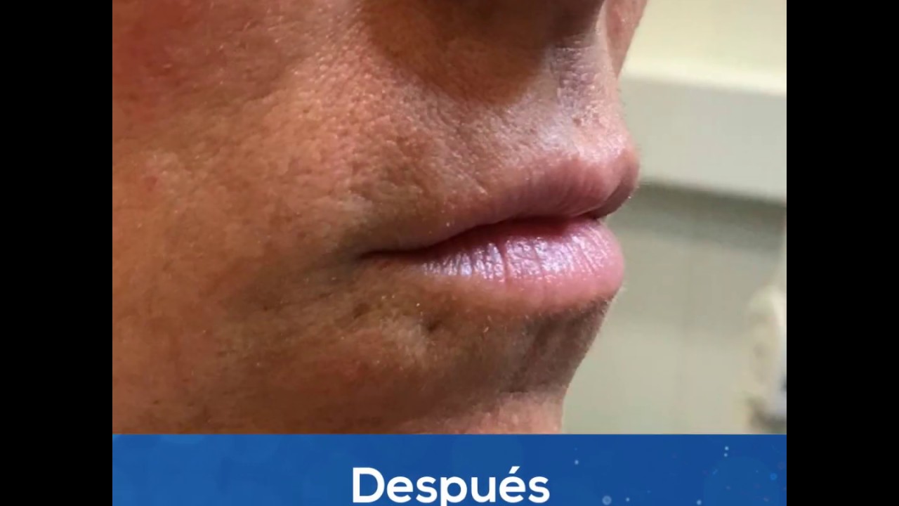 Juan Enrique Pérez Enríquez-175