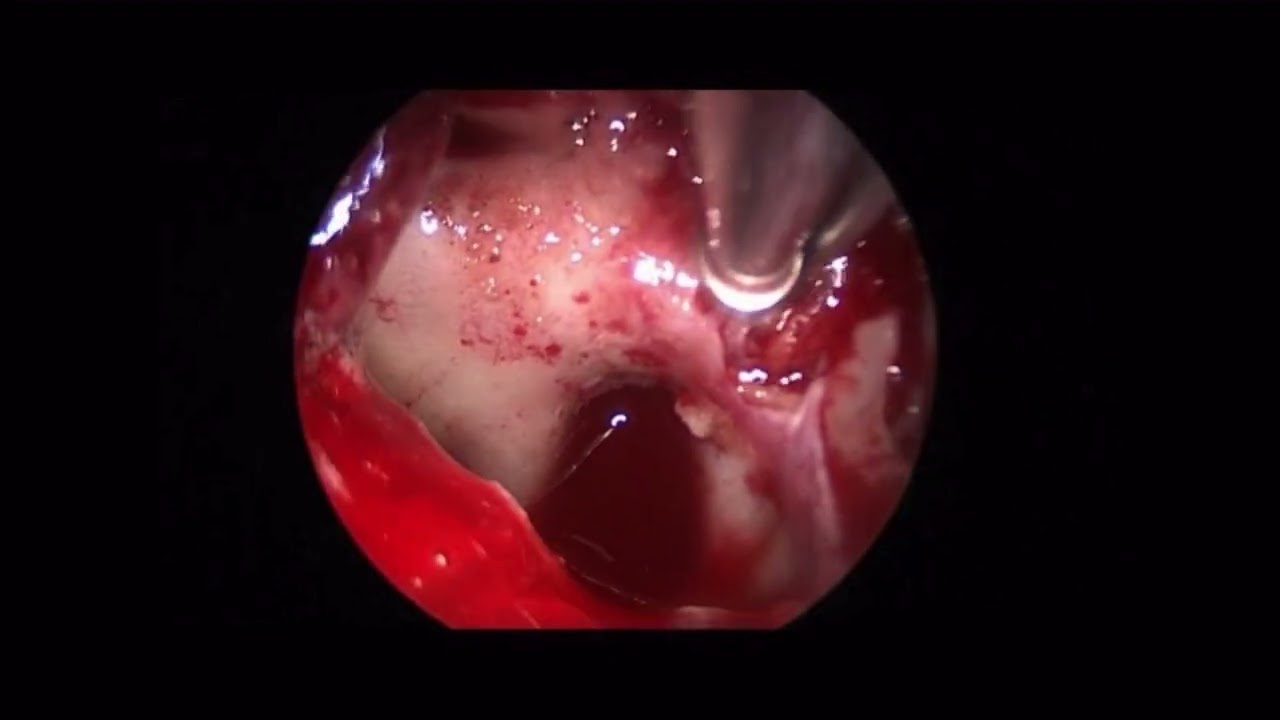 Riccardo Antonio Ricciuti-1