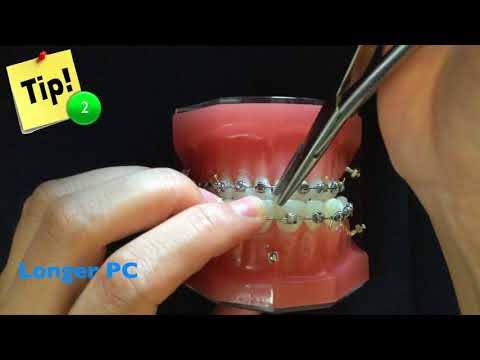 Chris' Tie: Ties by Power Chains｜【Chris Chang Ortho】CC453