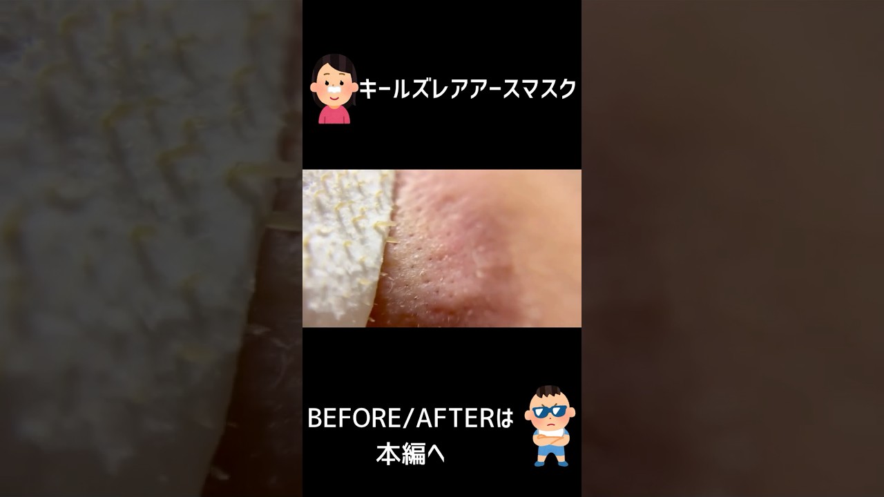 角栓と毛穴が目立たなくなるなんて