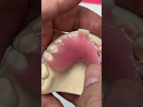 Temporary Partial for a Single Central Incisor