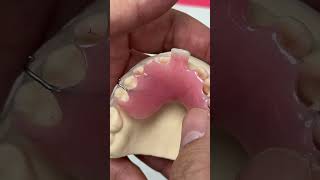 Temporary Partial for a Single Central Incisor