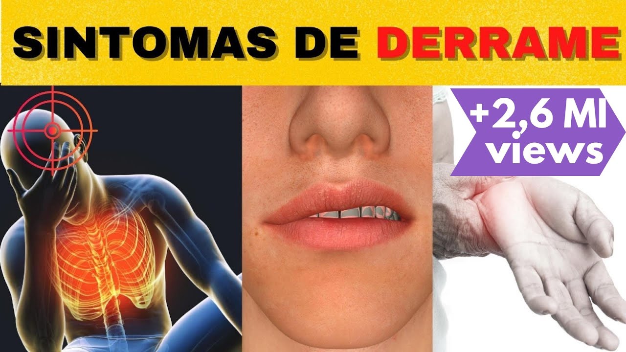 7 SINTOMAS QUE UM DERRAME ESTÁ A CAMINHO | causas, tratamento e como evitar um AVC