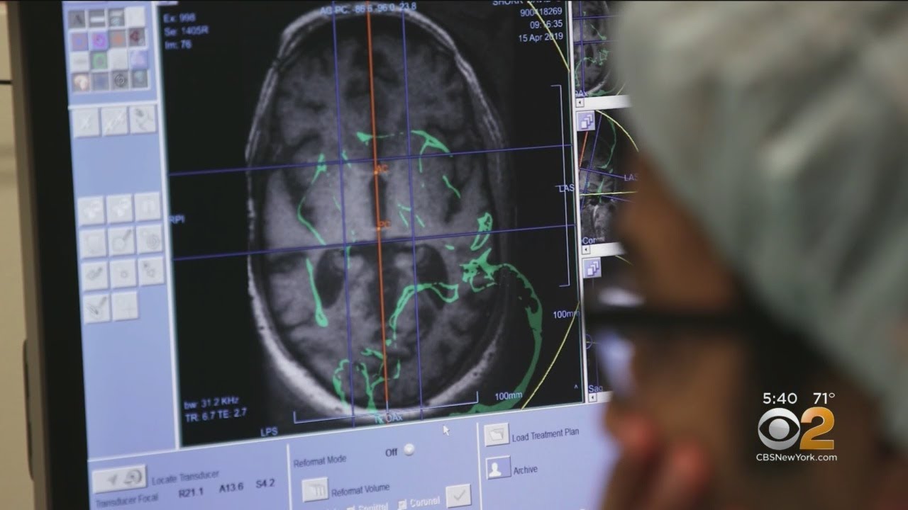 Opening Barriers To Brain Research