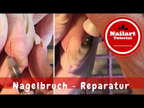 Difljukan die Rezensionen bei gribke der Nägel Gribok die Füsse der Tablette und der Salbe