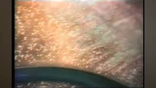 Garbage Man • Hole (rare verison)