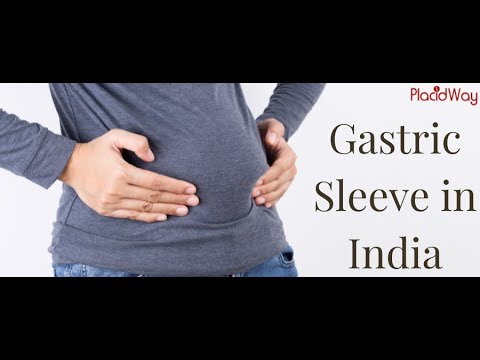 Gastric Sleeve in India