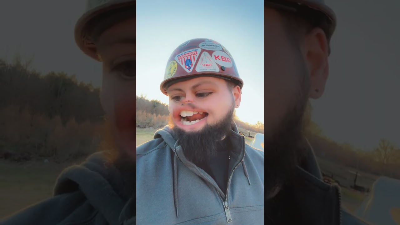 Roscoe got electrocuted at work! 