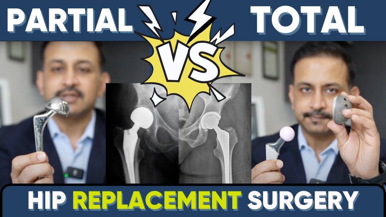 Side effects of partial hip replacement in young(English translation in comments)#hipreplacement