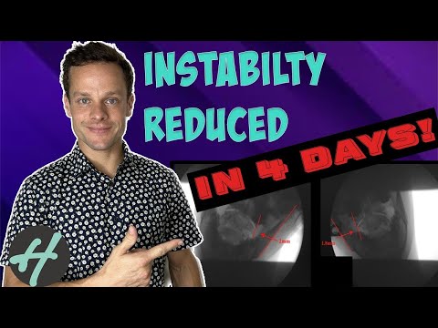 Atlanto Axial C1 C2 instability: Curve Correction, Suboccipital Tendon Dry Needling